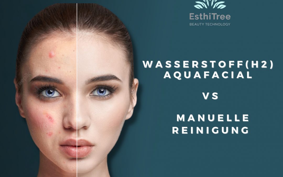 AquaFacial vs Manuelle Reinigung